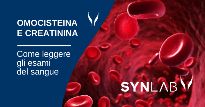 COME LEGGERE GLI ESAMI DEL SANGUE: OMOCISTEINA E CREATININA